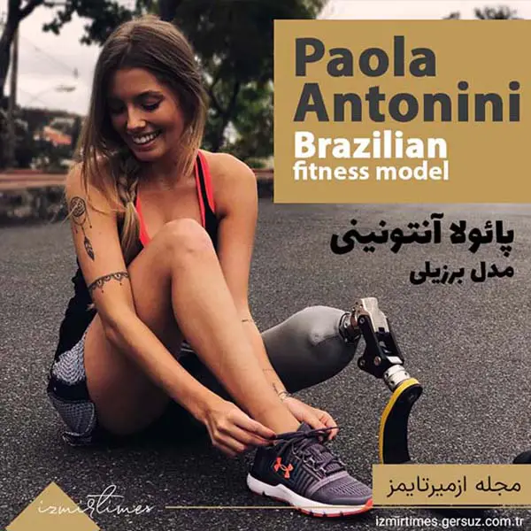 پائولا آنتونینی مدل برزیلی و محبوبیتش پس از معلولیت